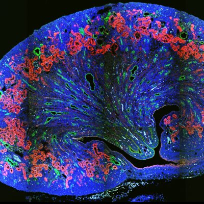 Cross section of a cystic kidney - Maria Rondon Galeano, UQ IMB